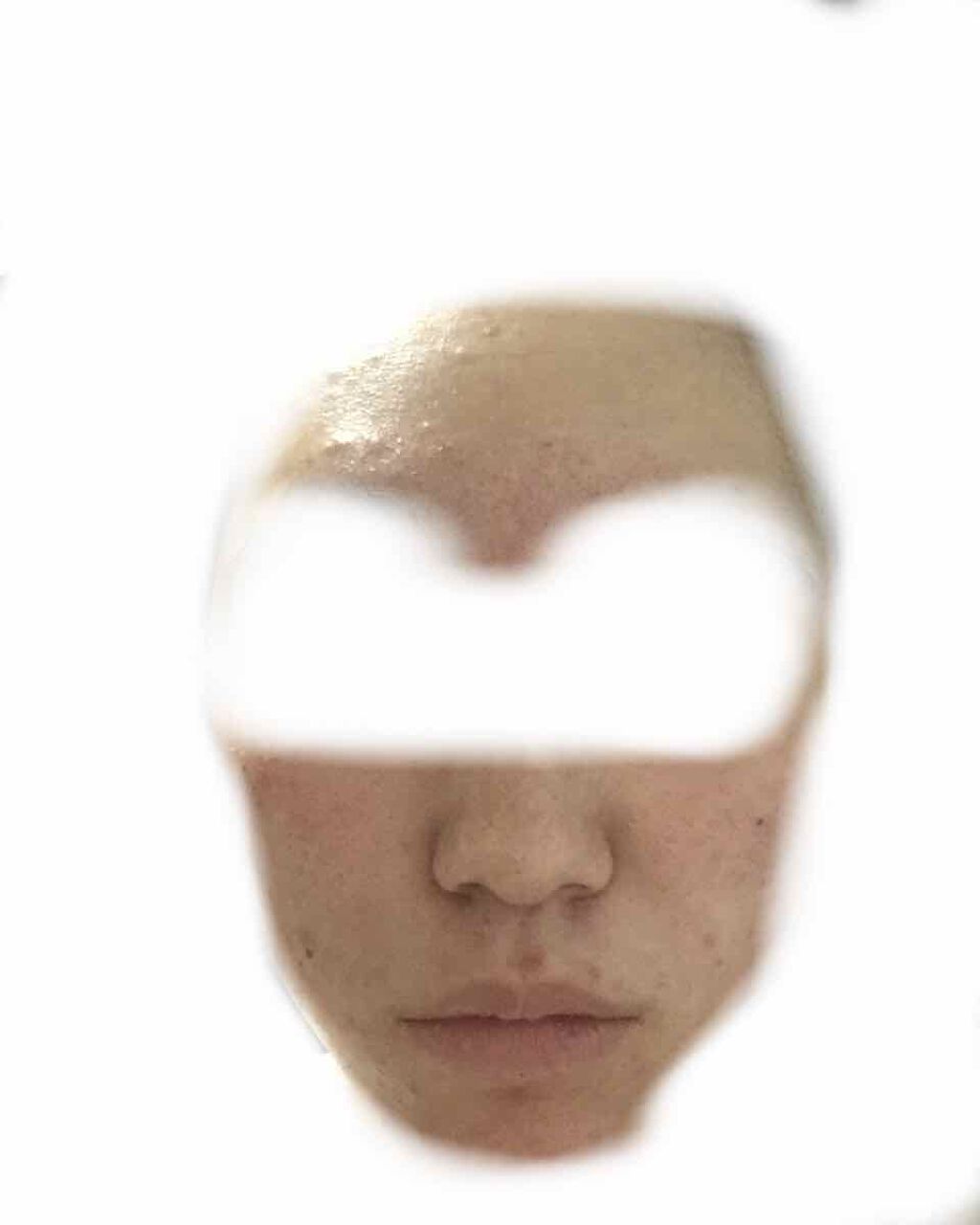 A アクネフォーム/NOV/洗顔フォームを使ったクチコミ(4枚目)