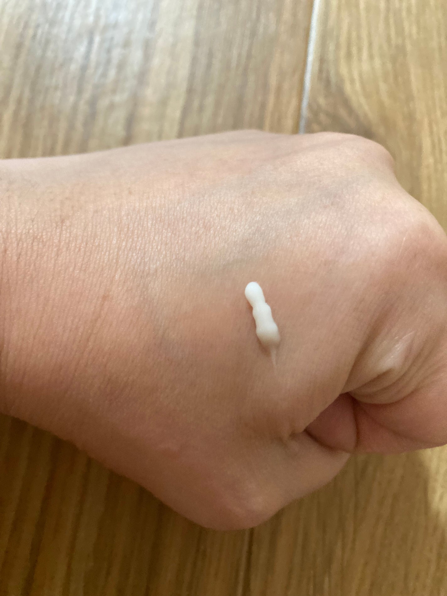 シカレチA クリーム0.05/VT/フェイスクリームを使ったクチコミ(3枚目)