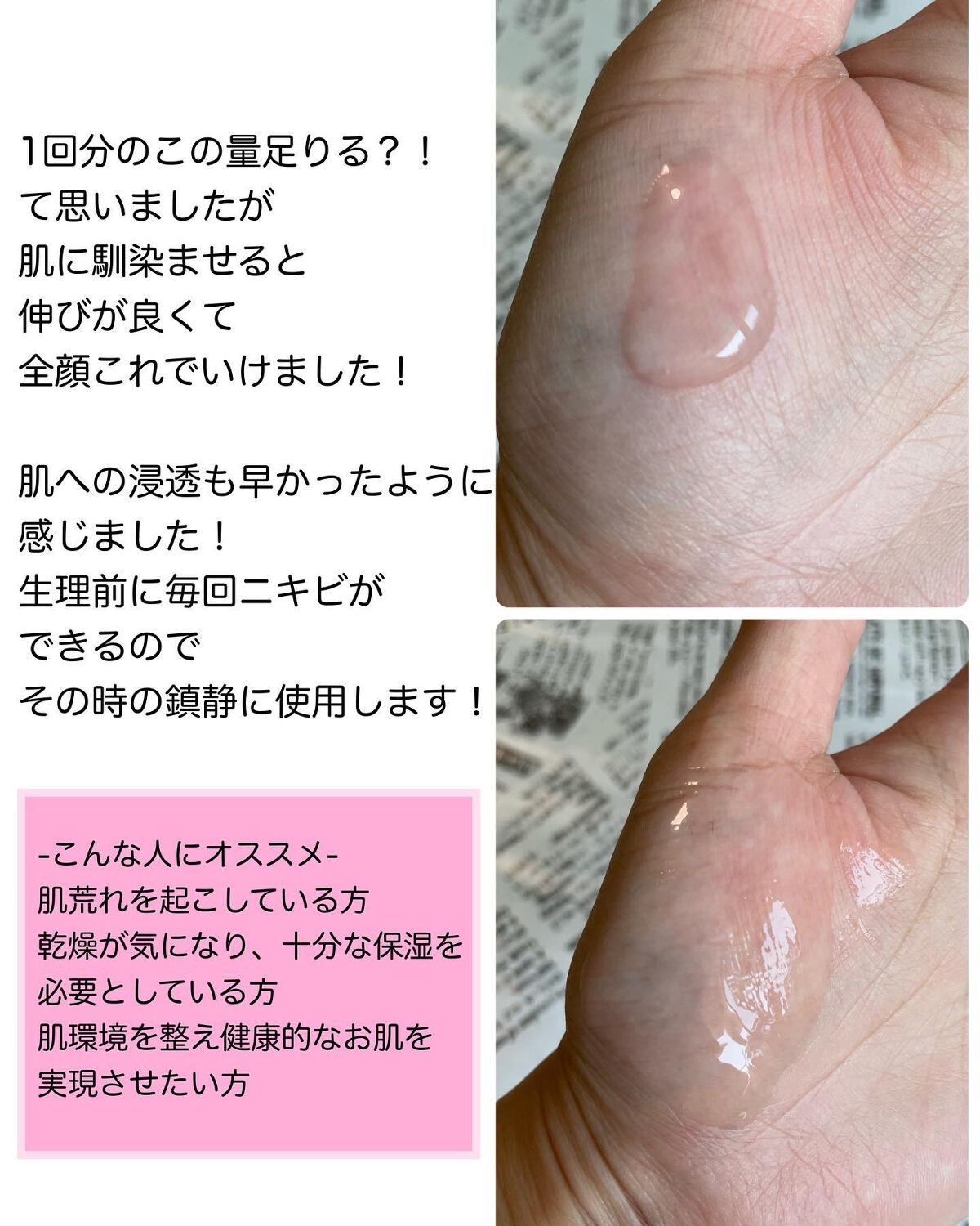 ピンクティーツリーシナジーセラム/APLIN/美容液を使ったクチコミ(3枚目)