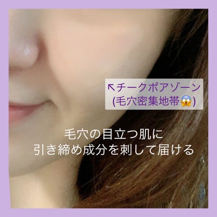 チークポアパッチ/北の快適工房/シートマスク・パックを使ったクチコミ(4枚目)