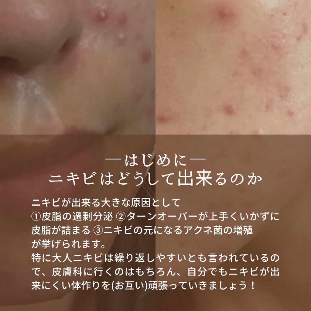 めぐりズム 蒸気でホットアイマスク 無香料/めぐりズム/ホットアイマスクを使ったクチコミ（2枚目）