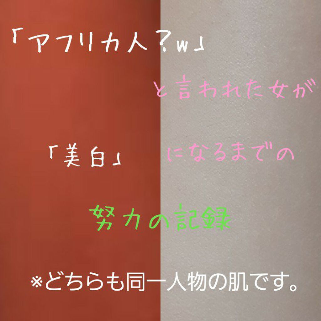 ハトムギ化粧水(ナチュリエ スキンコンディショナー R )/ナチュリエ/化粧水を使ったクチコミ(1枚目)
