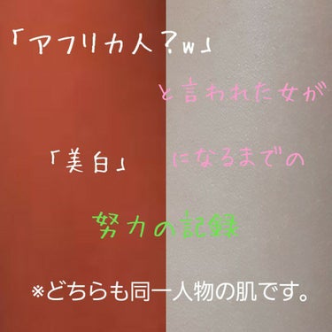 ღღ野球部より黒かった私の肌が生まれ変わりました〜6つの白くなる術ღღ

(( ٩(• •๑)ﾔｯﾎｰ)     珠莉です♡

私、もともと地黒で、めっちゃ黒かったんですよ。
でも、今は昔にくらべだいぶ