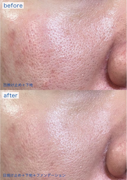 エッセンス スキングロウ ファンデーション 310 Silk / SHISEIDO エッセンス スキングロウ ファンデーション 310 Silk / SHISEIDO