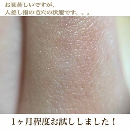 ベビーオイル ナチュラル/DAISO/ボディオイルを使ったクチコミ(2枚目)