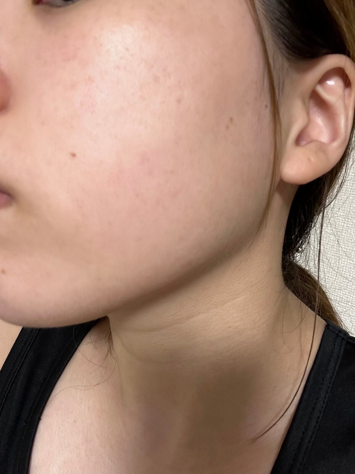 トラブルリペア リキッド/アルージェ/美容液を使ったクチコミ(4枚目)