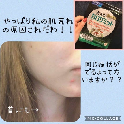 大人のカロリミット/ファンケル/ボディサプリメントを使ったクチコミ(1枚目)