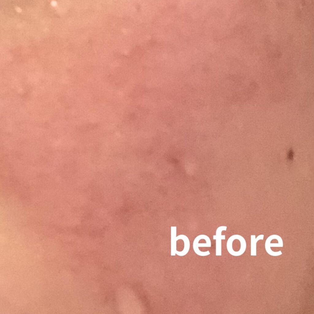 CICA デイリースージングマスク/VT/シートマスク・パックを使ったクチコミ（2枚目）