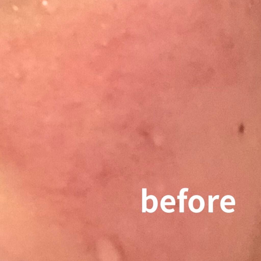 CICA デイリースージングマスク/VT/シートマスク・パックを使ったクチコミ(2枚目)