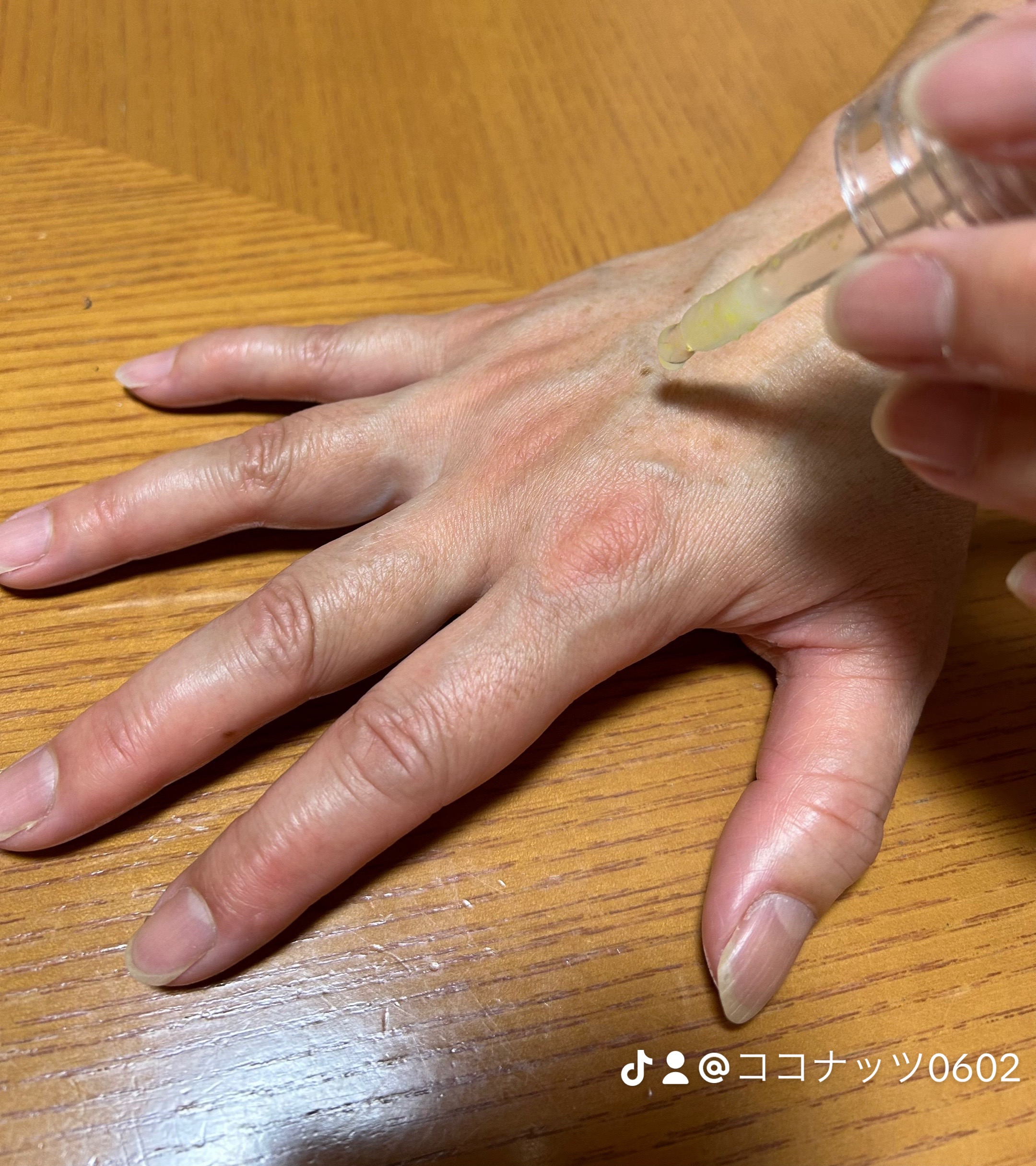 レチノコラーゲン低分子300パンピングアンプル/CKD/美容液を使ったクチコミ（3枚目）