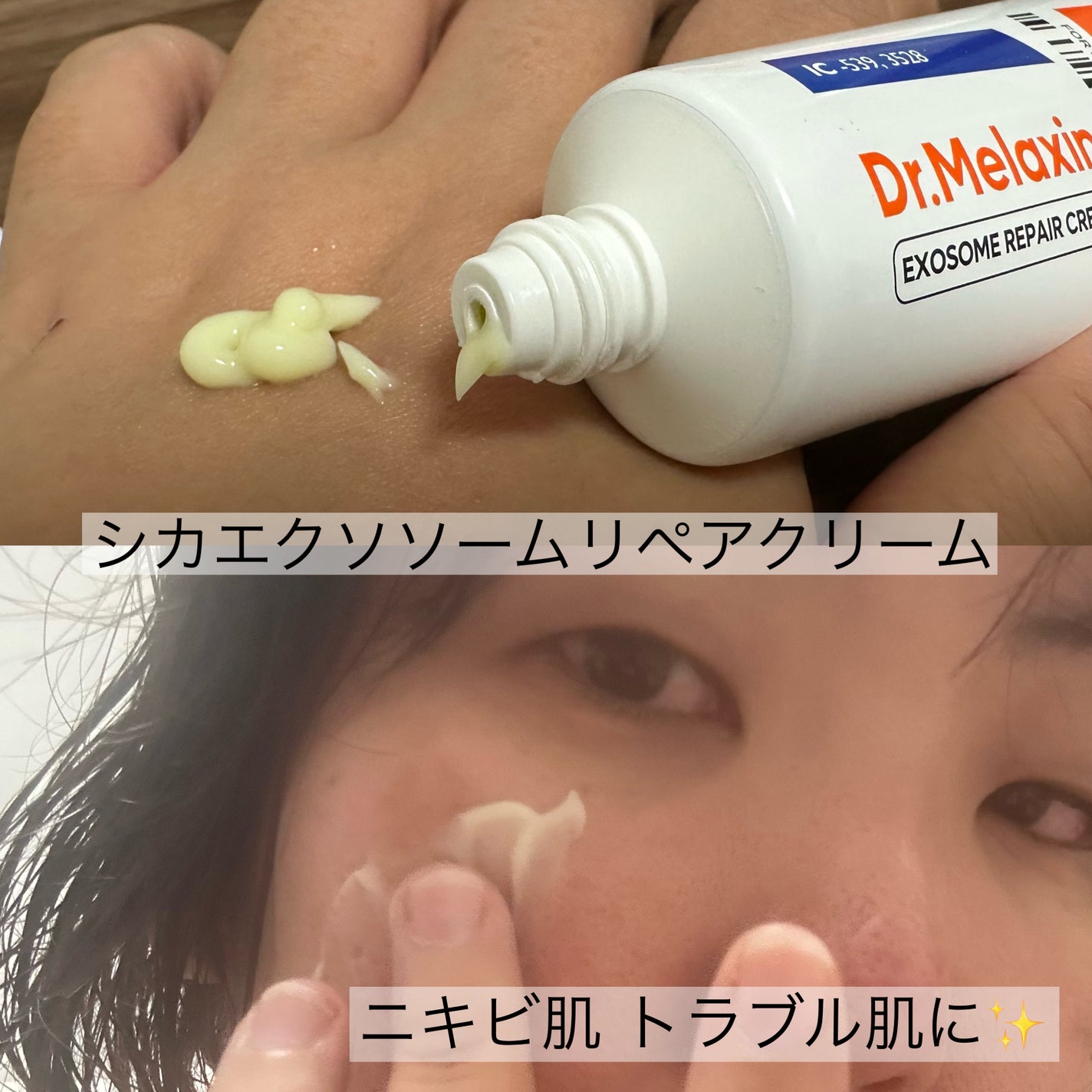 BP-PORE AMPOULE /Dr.Melaxin/美容液を使ったクチコミ(4枚目)