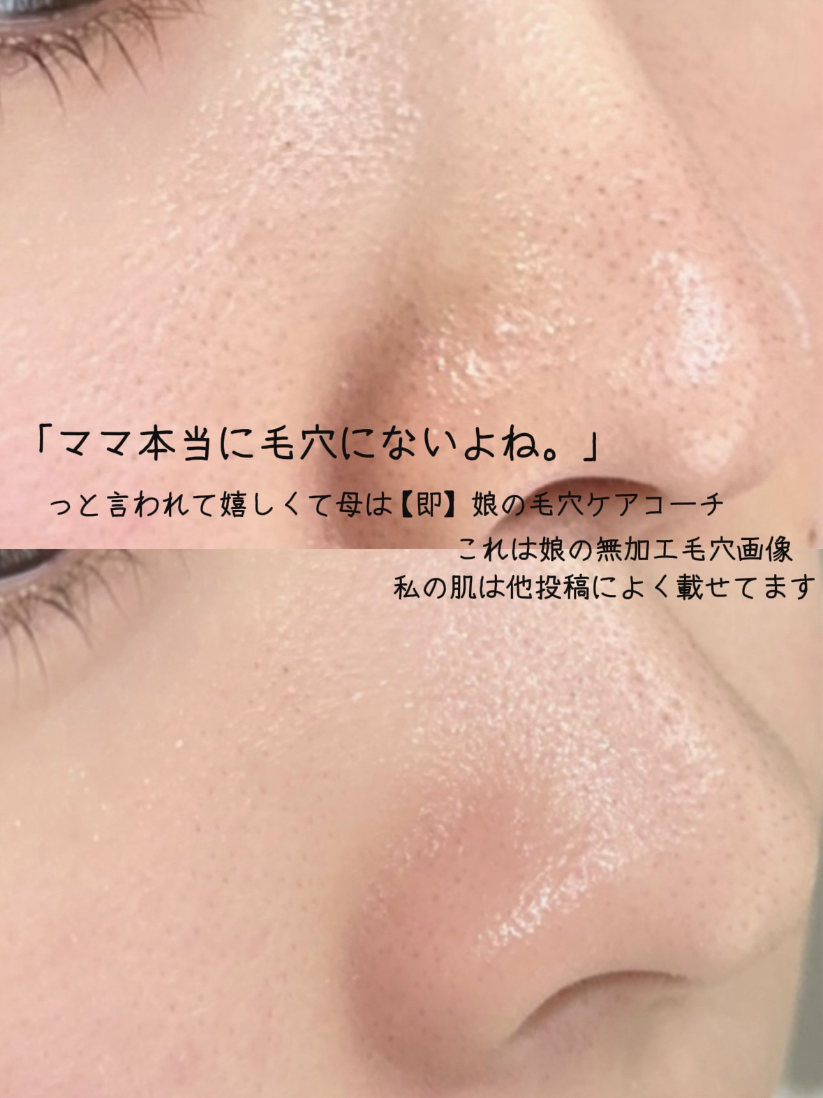 ピンシャー スキンクリアジェル/PINCHER/その他スキンケアを使ったクチコミ（2枚目）