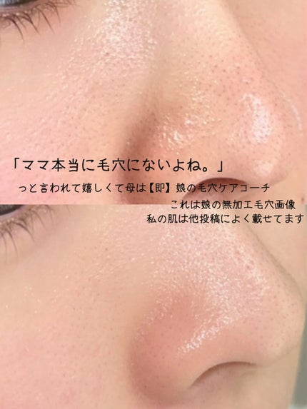 薬用クリア化粧水/メンソレータム アクネス/化粧水を使ったクチコミ(2枚目)