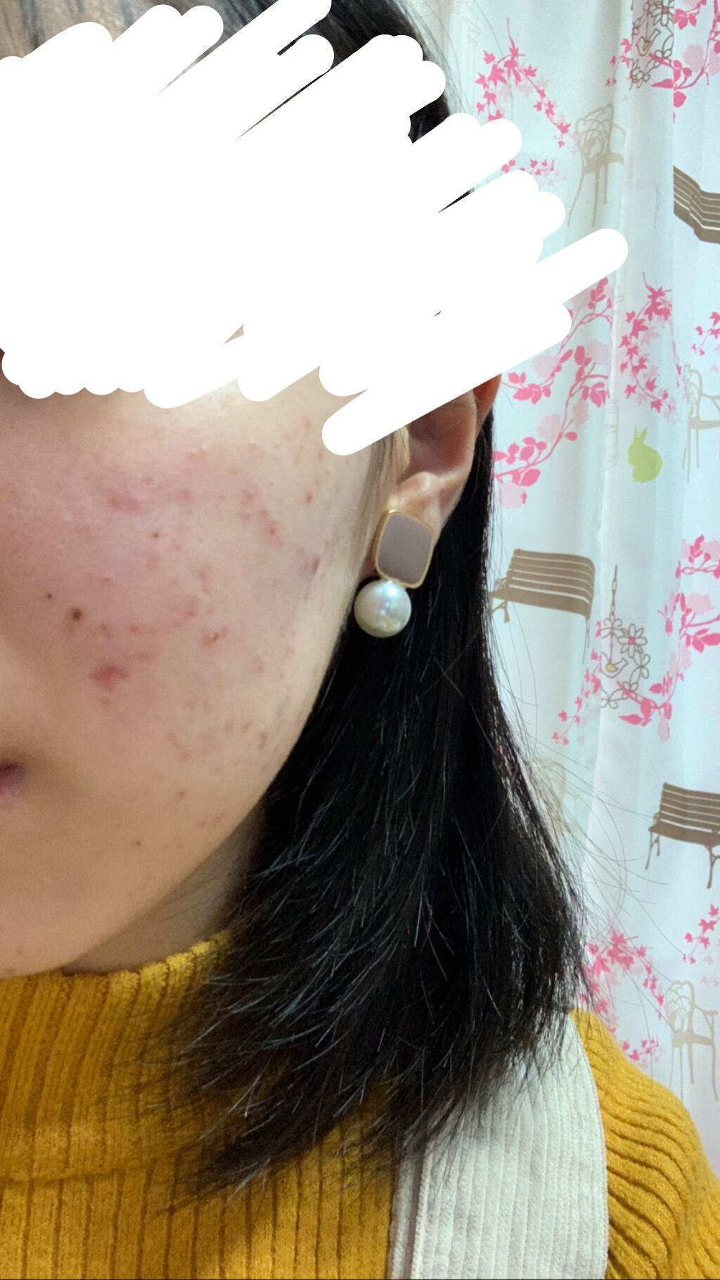 パルモアー(医薬品)/三宝製薬/その他を使ったクチコミ（1枚目）