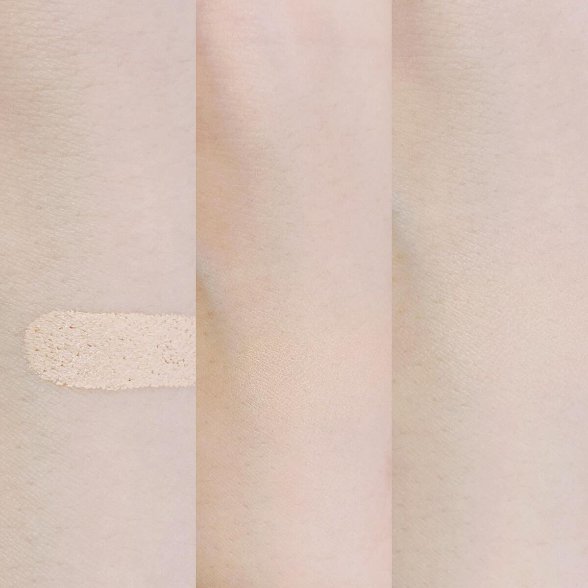 湘南美容コンシーラー/湘南美容/スティックコンシーラーを使ったクチコミ(6枚目)