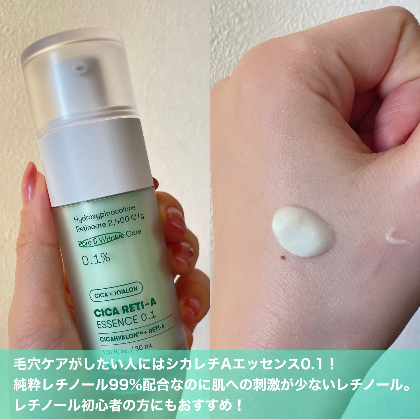 シカレチA エッセンス0.1/VT/美容液を使ったクチコミ(5枚目)