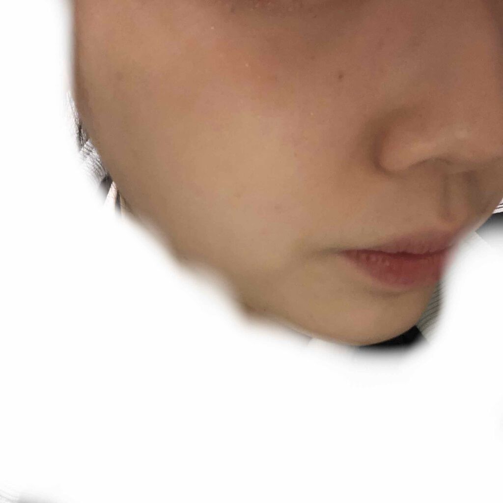 マシュマロホイップ 薬用アクネケア/ビオレ/泡洗顔を使ったクチコミ（2枚目）