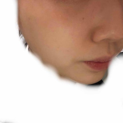 マシュマロホイップ 薬用アクネケア/ビオレ/泡洗顔を使ったクチコミ(2枚目)