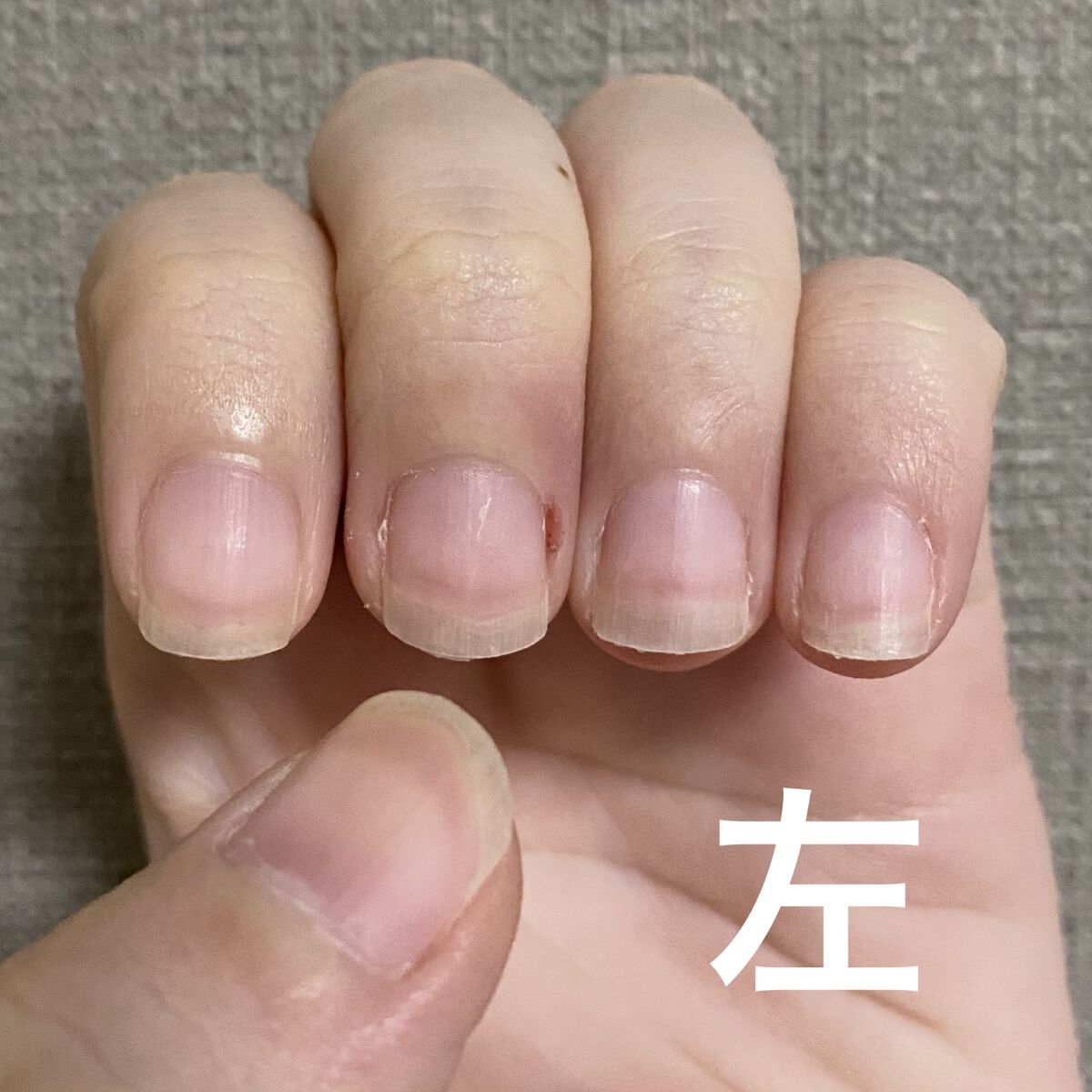 ネイルエンビー/O・P・I/ネイルオイル・トリートメントを使ったクチコミ（3枚目）