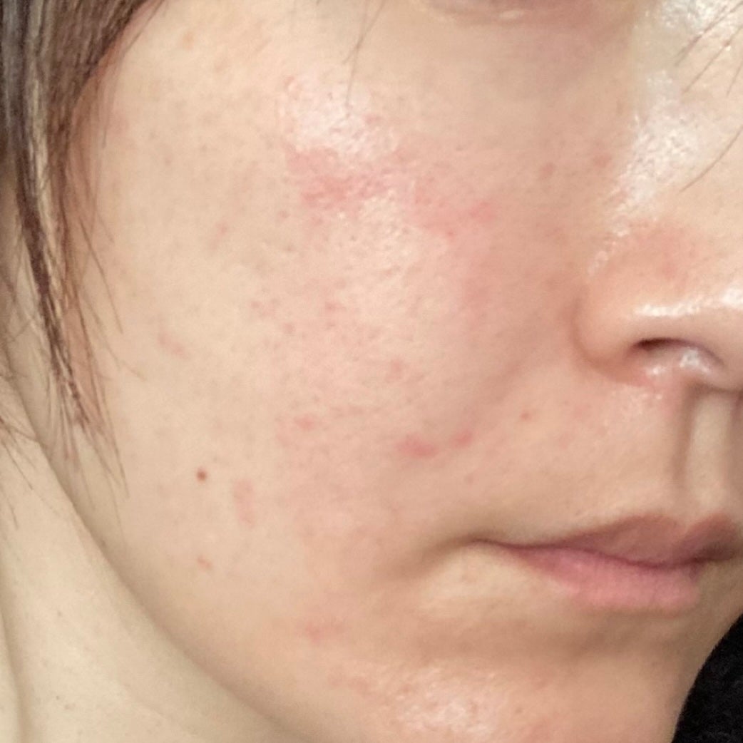 ããðŠçŸå®¹æçš¿ããæ¹ãã©ãã on LIPS ã44æãiPhoneããŒãã«ã«ã¡ã©ãã£ãŽãç¡å å·¥åçããªããŠã..ãïŒ5æç®ïŒ