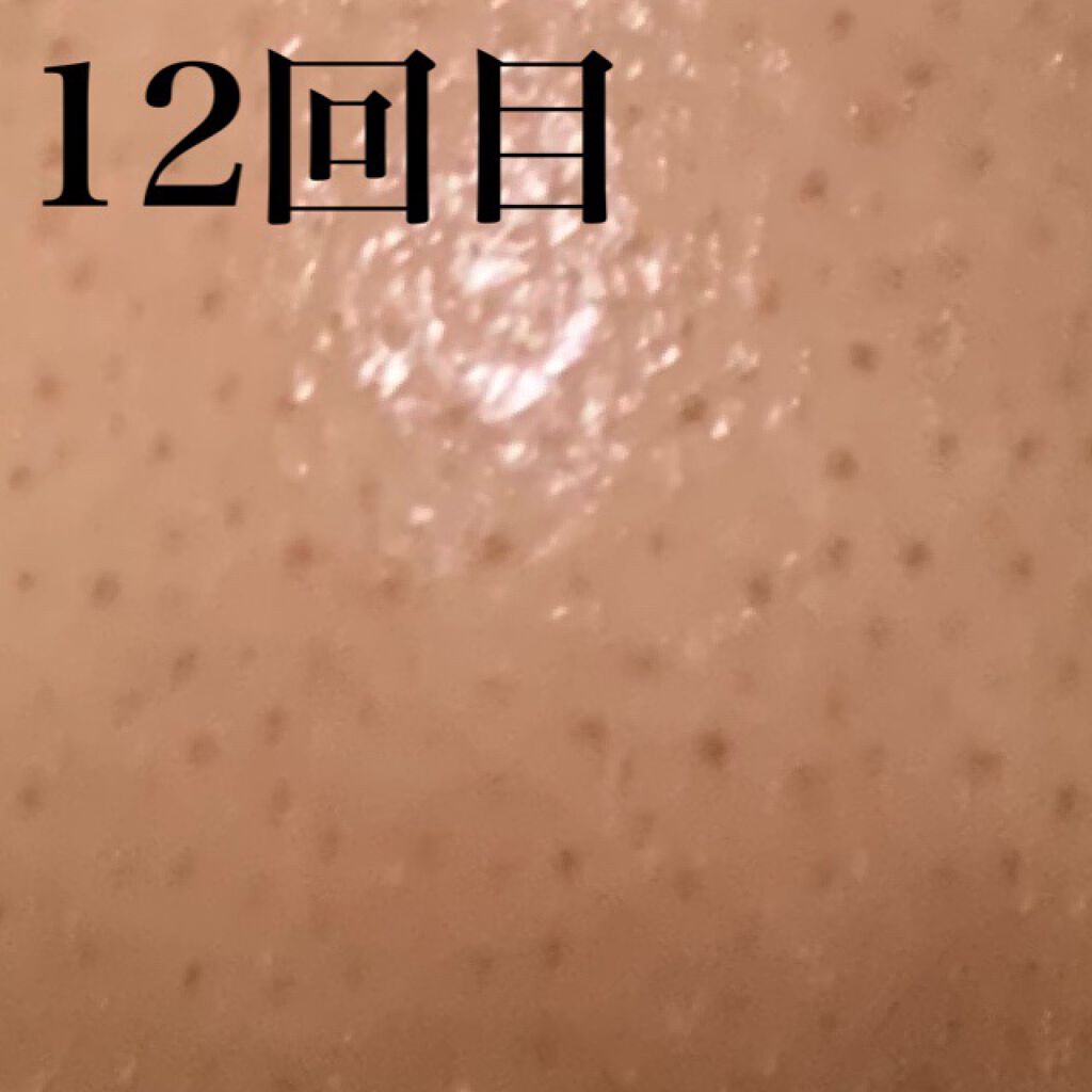 アボカドチーズ on LIPS 「毛穴記録週2のペースでつかっています!まだ劇的な変化はありませ..」(4枚目)