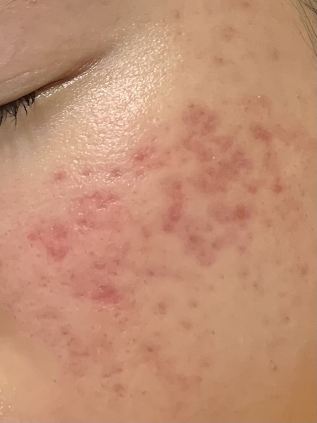 化粧水・敏感肌用・しっとりタイプ/無印良品/化粧水を使ったクチコミ（3枚目）