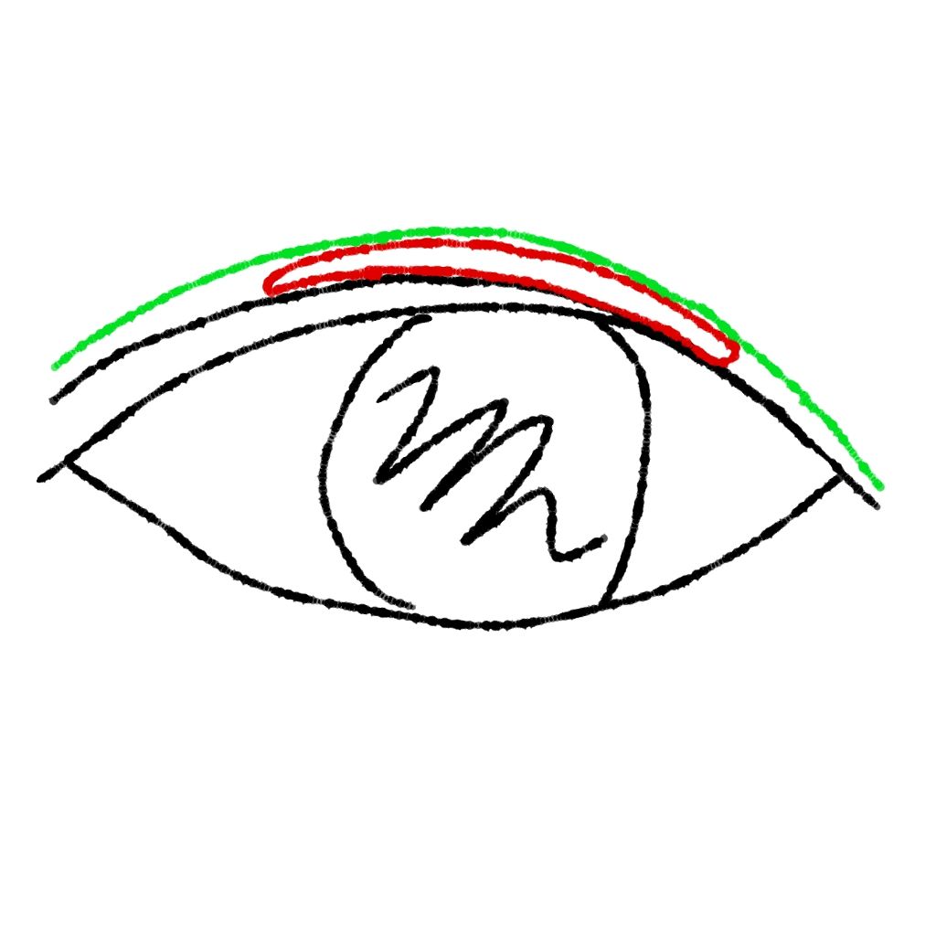 アイテープ(絆創膏タイプ、レギュラー、70枚)/DAISO/二重まぶた用アイテムを使ったクチコミ(2枚目)