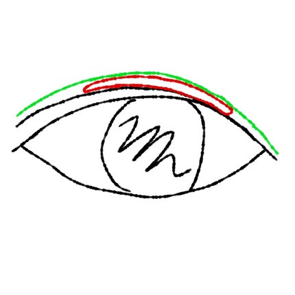 アイテープ(絆創膏タイプ、レギュラー、70枚)/DAISO/二重まぶた用アイテムを使ったクチコミ(2枚目)