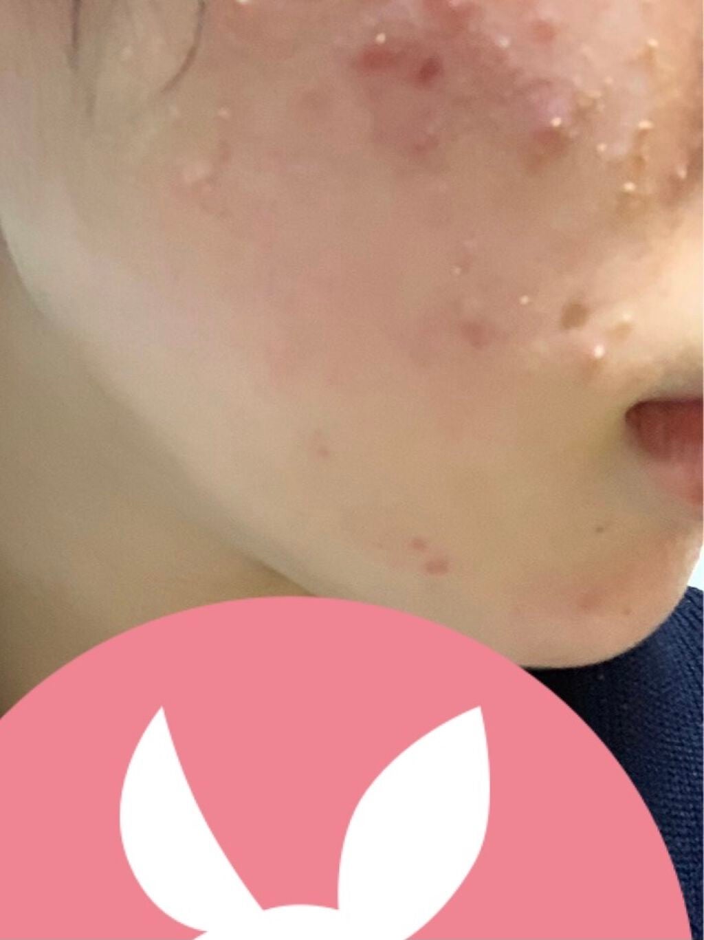 アンブリオリス モイスチャークリーム/アンブリオリス/フェイスクリームを使ったクチコミ(1枚目)