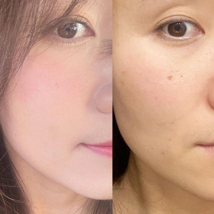 ピンクティーツリーカバークッション/APLIN/クッションファンデーションを使ったクチコミ(4枚目)