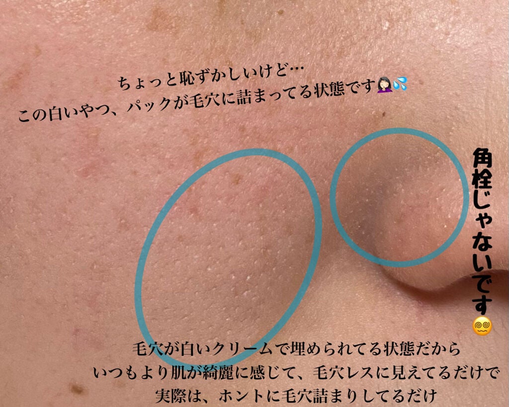 薬用ホワイトパックN/透明白肌/洗い流すパック・マスクを使ったクチコミ(4枚目)