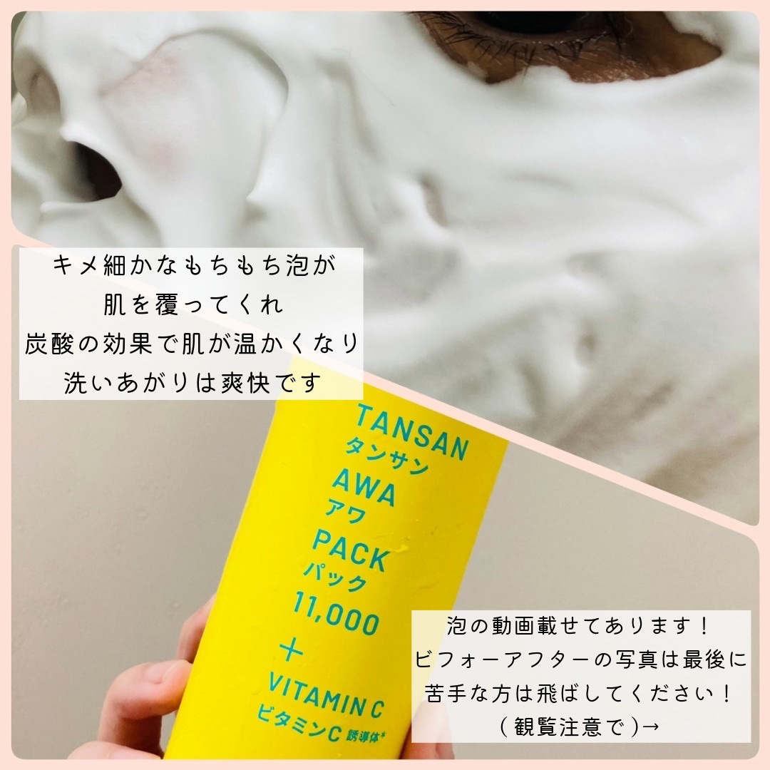 SHEE BY LITS 炭酸美容パック/リッツ/洗い流すパック・マスクを使ったクチコミ（2枚目）