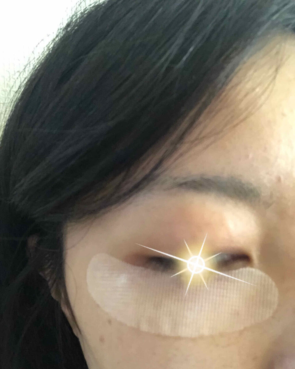 ナチュラベーレ THEマイクロニードル/ナチュラベーレ/シートマスク・パックを使ったクチコミ（3枚目）