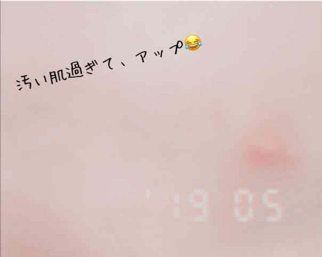 薬用アクネモイストジェル/DAISO/フェイスクリームを使ったクチコミ(2枚目)