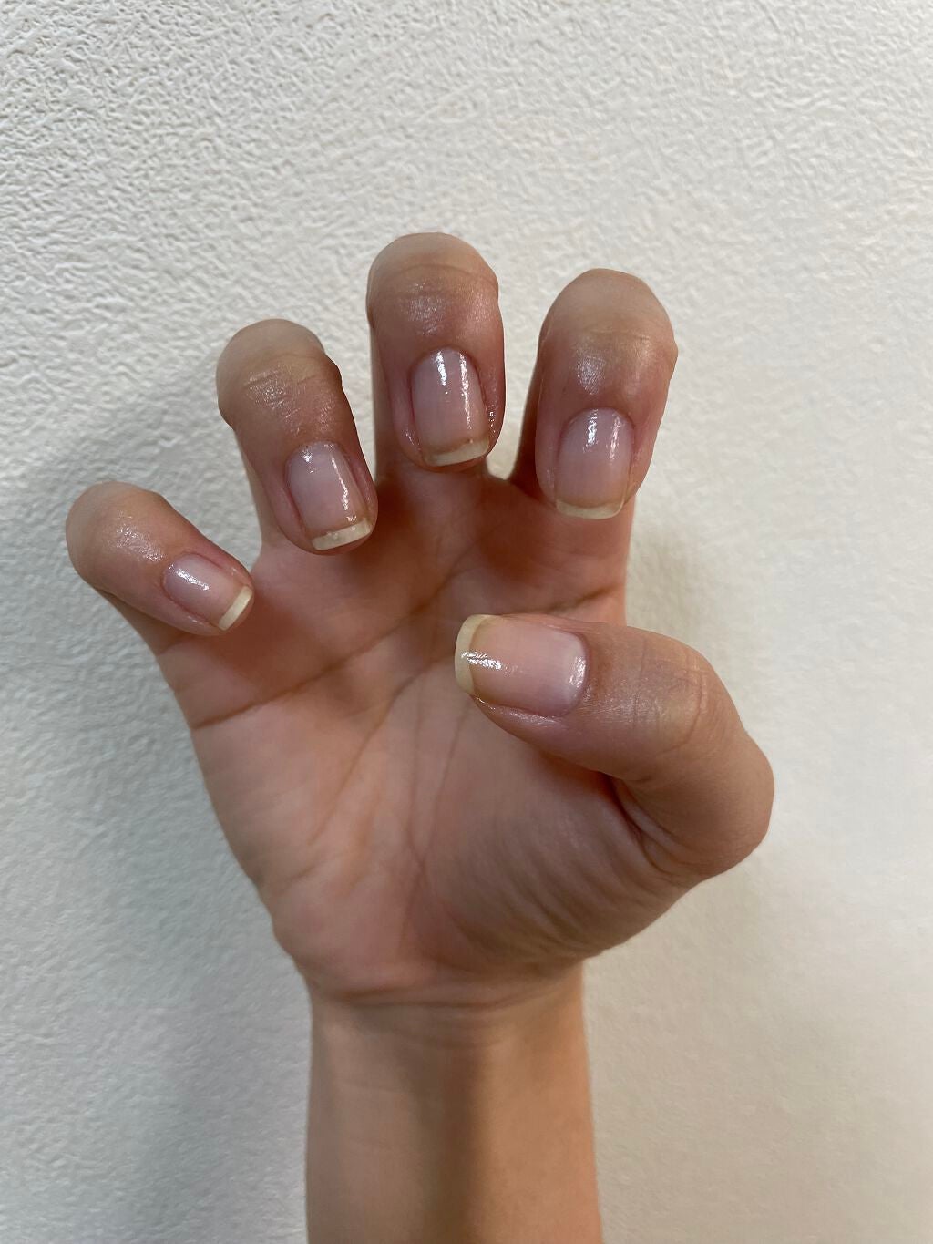 のちゃん on LIPS 「2021/11/6投稿10日目中指の傷がほぼ治ってきた!うれし..」(2枚目)