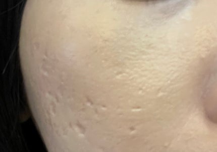 リキッドコンシーラー ピンクパープル/WHOMEE/リキッドコンシーラーの画像