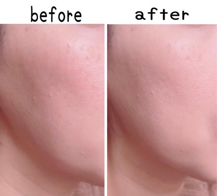 ブラーカバークッション/LUNA/クッションファンデーションを使ったクチコミ(7枚目)