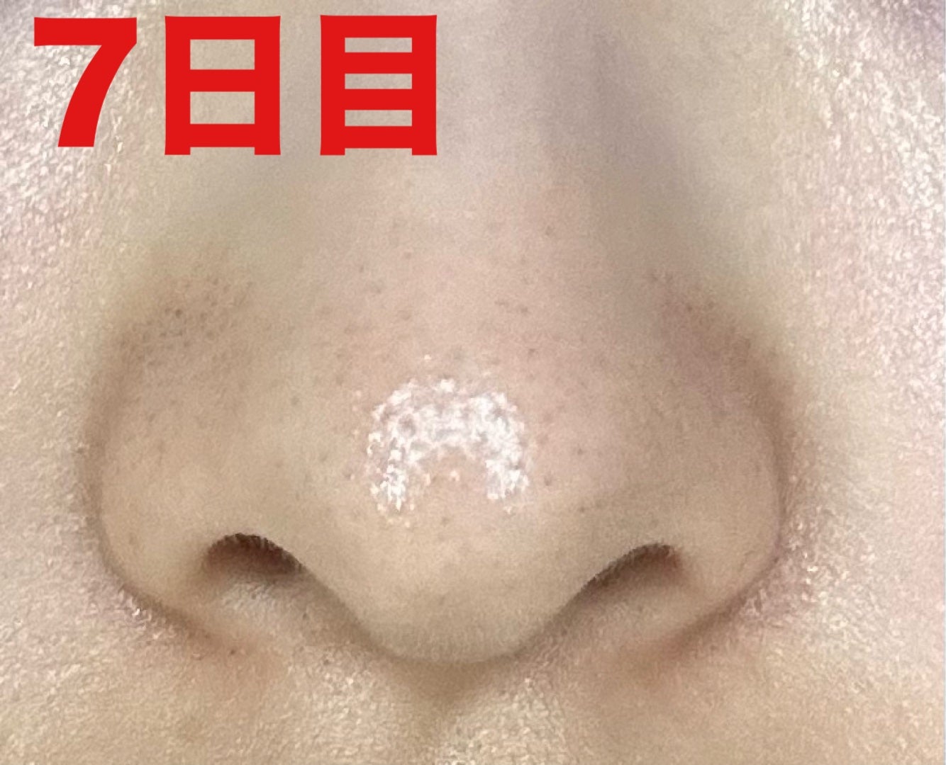 薬用 しみ 集中対策 美容液/メラノCC/美容液を使ったクチコミ(3枚目)