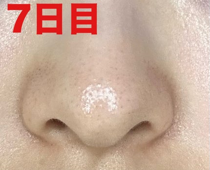 薬用 しみ 集中対策 美容液/メラノCC/美容液を使ったクチコミ(3枚目)