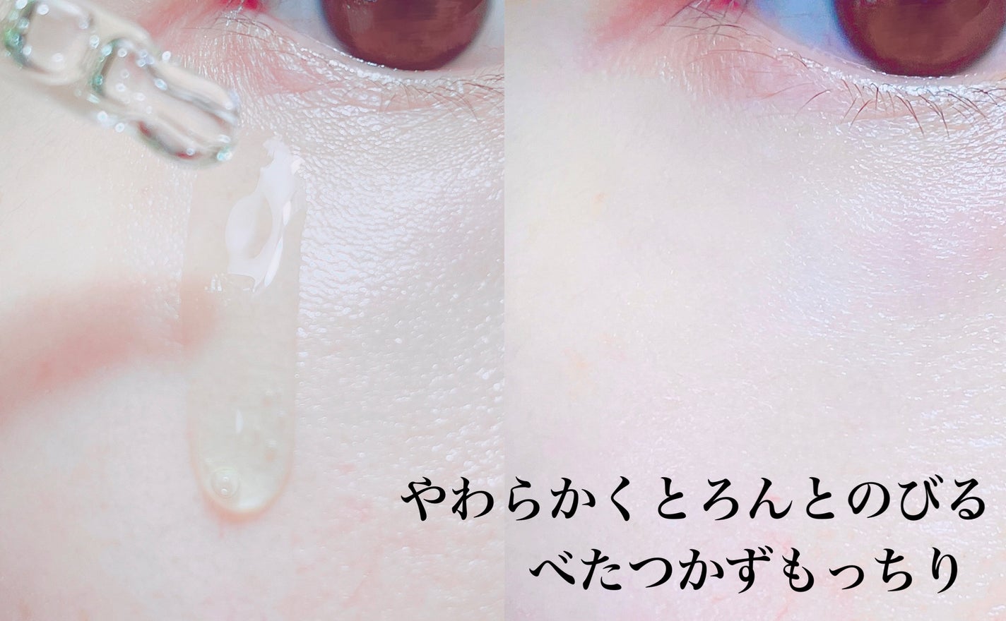 エクソソームシカ アンプル/MEDICUBE/美容液を使ったクチコミ(4枚目)