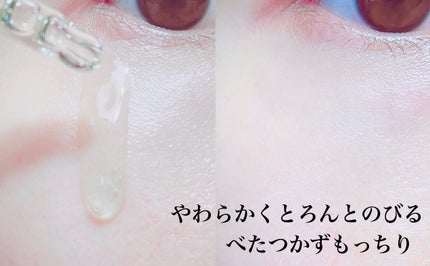 エクソソームシカ アンプル/MEDICUBE/美容液を使ったクチコミ(4枚目)