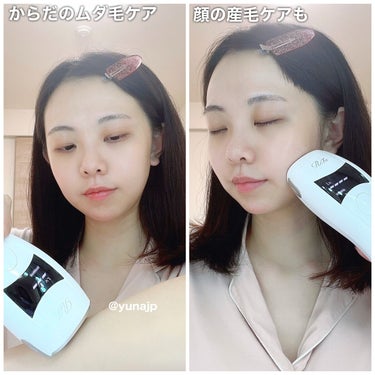 ＼自宅で簡単にできるムダ毛ケア♡／
ヘアケアシリーズで大人気なReFaからなんと！ムダ毛ケアの光美容器が発売されました🥺
⁡
ReFa BEAUTECH EPI
30,000円税込
⁡
ムダ毛ケアって「人によって刺激刺激を感じる」、「通う時間を取るのが難しい」、「継続的な支払いが苦手」というイメージが強いよね…
そんな常識を変える光美容器が誕生した✨
⁡
☑︎手に取りやすい価格
☑︎顔にも使える！ほぼ全身のケアがこの1台で完結
☑︎美肌効果で肌のハリとうるおいケアも
⁡
フェイス用のアタッチメントもついていて、顔にも使えるから早速顔に使ってみた♡
⁡
照射レベルは1〜5段階で、自分が安心して使えるパワーに設定できる
熱の感じ方は人それぞれだけど、個人的にあまり気にせず快適に使える感じです☺️
⁡
直感的な操作&軽いので初心者でも使いやすい！
連続照射できるAUTOモードもあってすごい便利でした！
⁡
いろんなムダ毛ケアをしてきましたが、使い続けやすく満足しています。お肌スベスベを目指すよ！
⁡
なかなかサロンに通う時間がないからこれなら楽に続けられますね♪
⁡
*:・゜。*:・゜*:・゜。*:・゜。*:
気になる方はぜひチェックしてみてね🥳
⁡
#ReFa #リファ #ReFaタイム #リファビューテックエピ
 #コスメコンシェルジュ #コスメ #コスメレビュー #コスメマニア #コスメ垢 #コスメオタク #コスメ好きさんと繋がりたい #コスメ好きな人と繋がりたい #コスメ好き #メイク #メイク好きさんと繋がりたい #コスメレポ #美容好きな人と繋がりたいの画像 その2