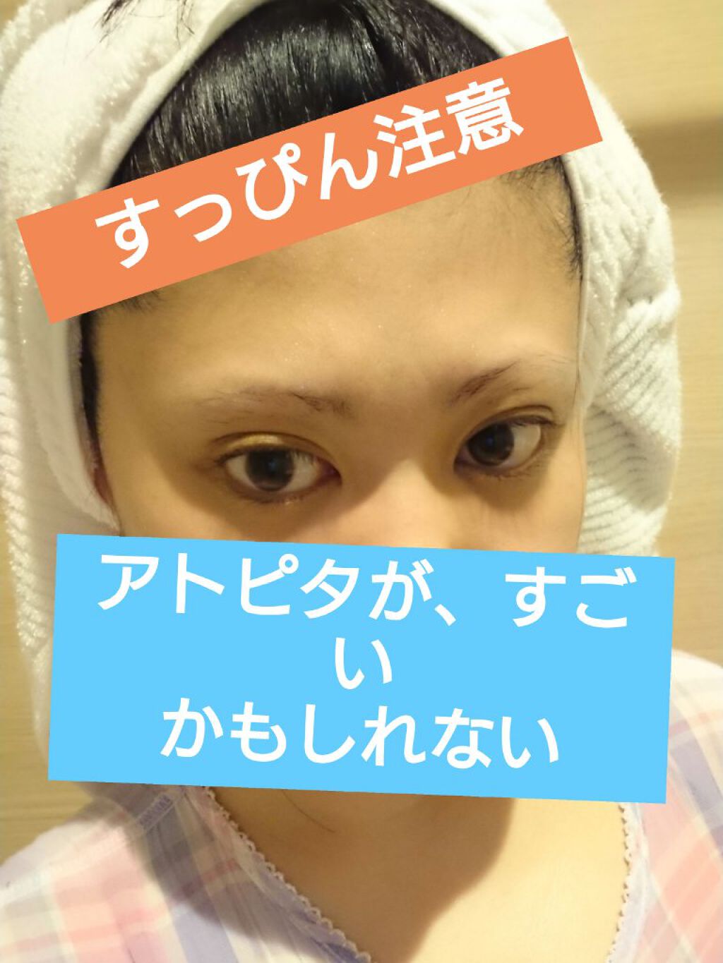 保湿全身ミルキィローション アトピタの口コミ 無加工すっぴん注意ですアトピタの 保湿全 By 拓 たく 基本フォロバいたします 混合肌 30代前半 Lips