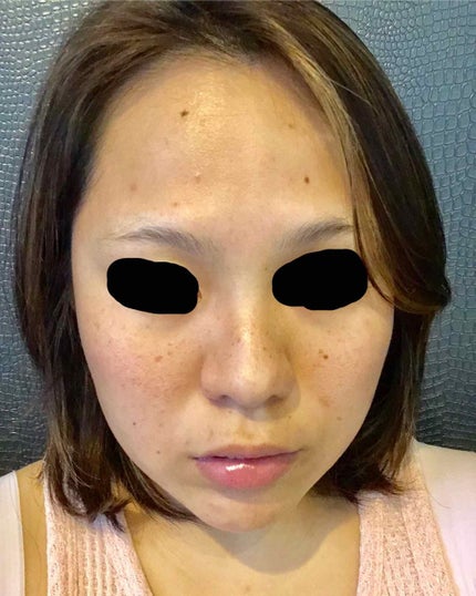 アクティブデイリービタミン/オルビス/美容サプリメントを使ったクチコミ(4枚目)