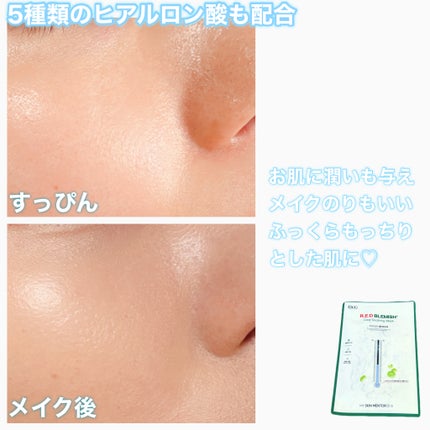 レッドブレミッシュ クールスージングマスク/Dr.G/シートマスク・パックを使ったクチコミ(6枚目)