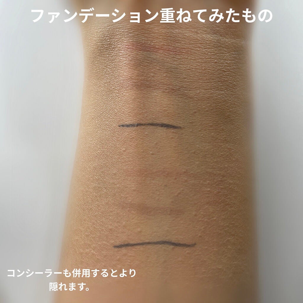 【旧】ディオールスキン フォーエヴァー スキン コレクト コンシーラー/Dior/リキッドコンシーラーを使ったクチコミ(3枚目)