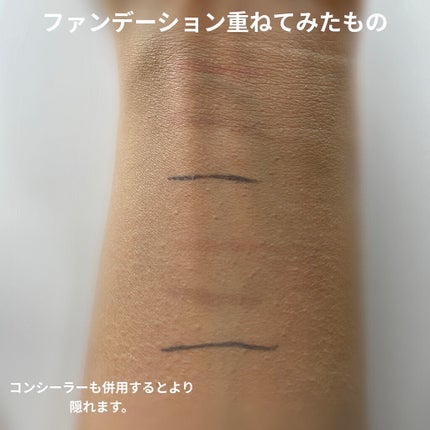 【旧】ディオールスキン フォーエヴァー スキン コレクト コンシーラー/Dior/リキッドコンシーラーを使ったクチコミ(3枚目)