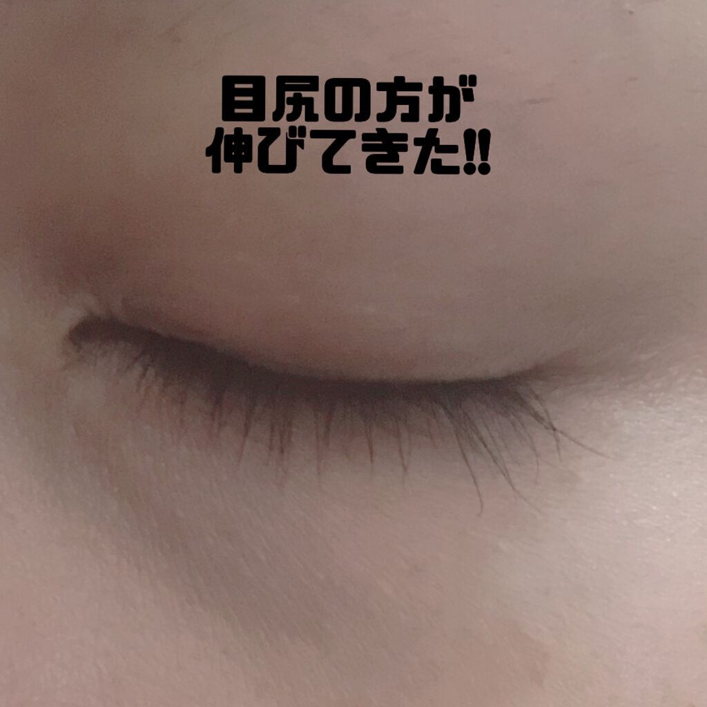 ラッシュアディクト アイラッシュコンディショニングセラム/soaddicted/まつげ美容液を使ったクチコミ（2枚目）