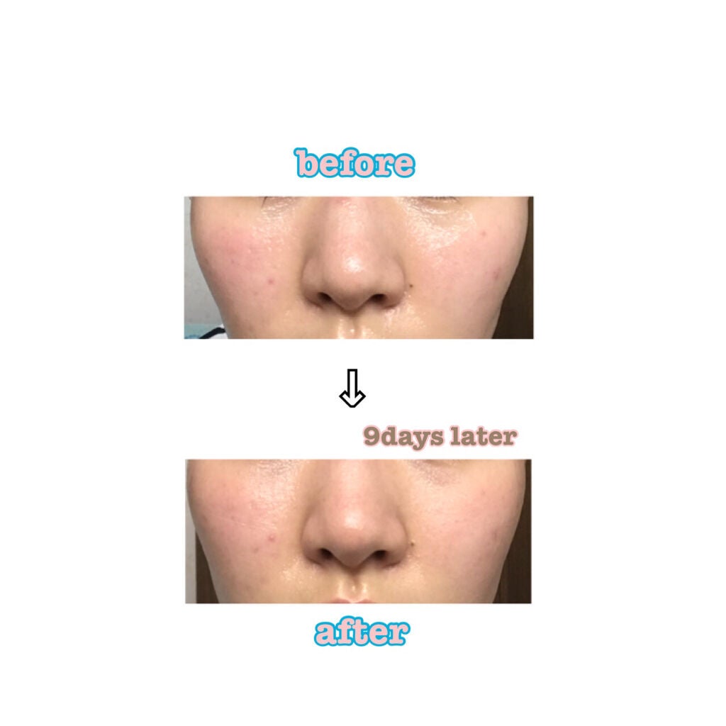 デュオ ザ クレンジングバーム/DUO/クレンジングバームを使ったクチコミ(4枚目)