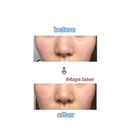 デュオ ザ クレンジングバーム/DUO/クレンジングバームを使ったクチコミ(4枚目)